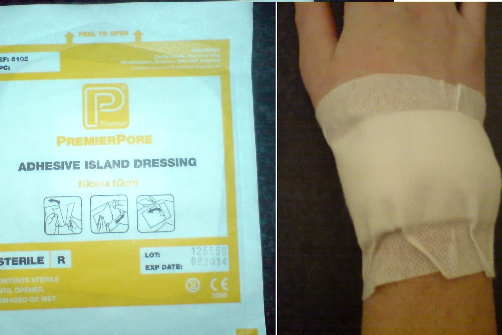 An adhesive dressing used to cover a wound.